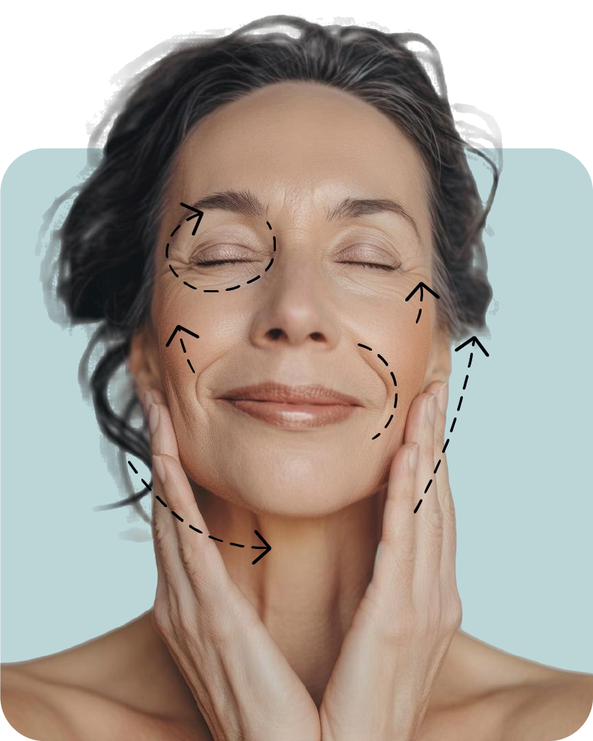 Armonización Facial