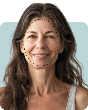 Full Face