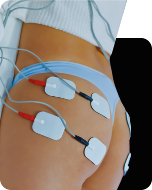 Electroestimulación